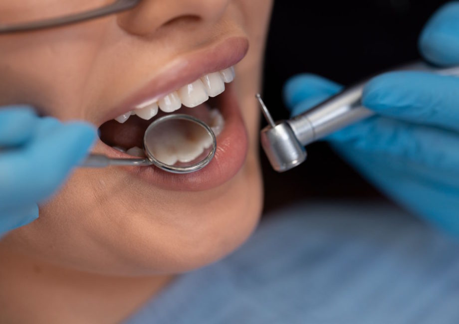 Opanuj techniki leczenia kanałowego: Twoja droga do zdrowych zębów